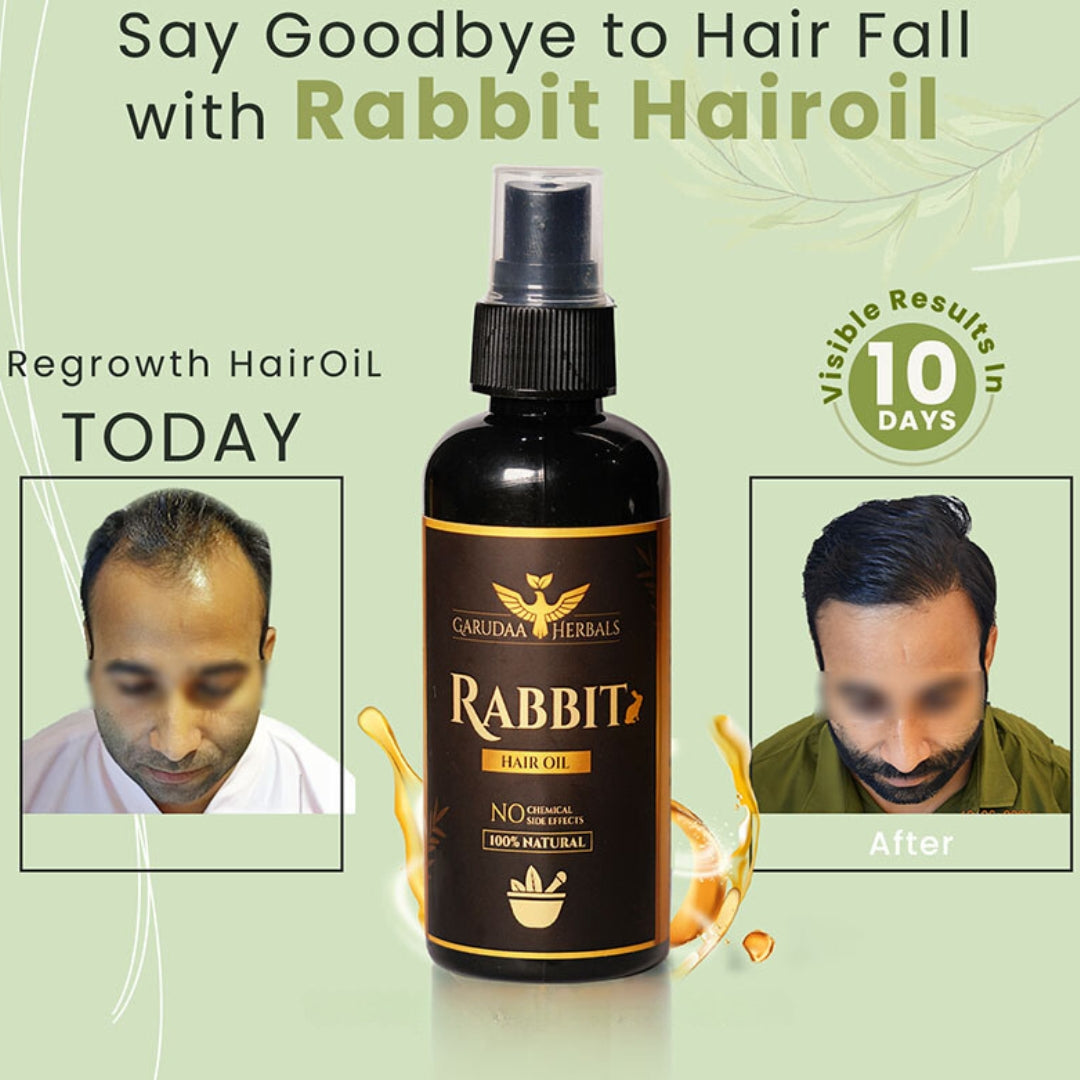 Garudaa Herbals Rabbit Hair Growth Oil 100ml (Pack of 2) 🔥 BUY 1 GET 1 FREE 🔥